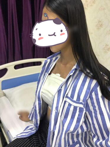 琴面假體隆胸前