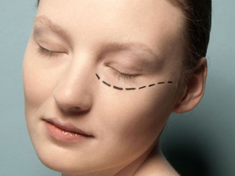 青島王博士醫(yī)學美容門診部手術祛眼袋