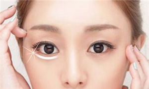 上海弘康醫(yī)院醫(yī)療美容科吸脂祛眼袋