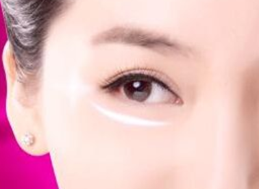 廈門亮媞整形吸脂祛眼袋