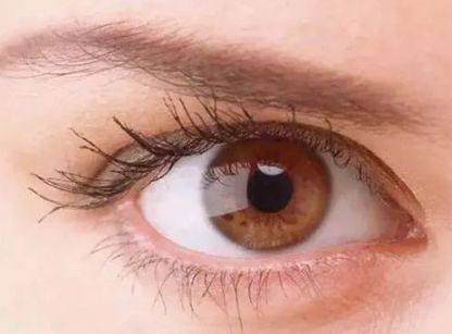 上海首爾麗格整形醫(yī)院祛眼袋