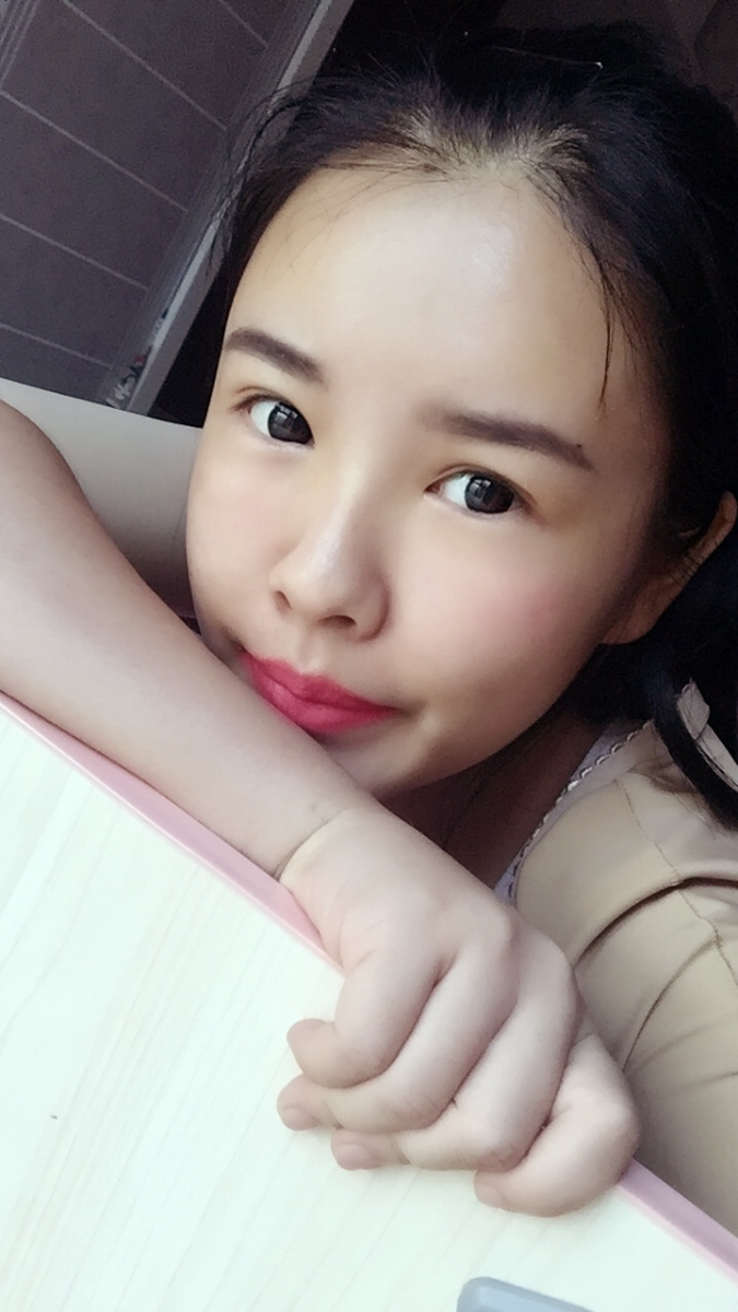 西安莎曼妃醫(yī)療美容醫(yī)院醫(yī)生樸俊做自體脂肪豐太陽穴效果怎么樣？