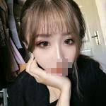 濟(jì)南鵬愛整形醫(yī)生楊力做顴骨顴弓整形技術(shù)怎么樣？楊力醫(yī)生案例展示