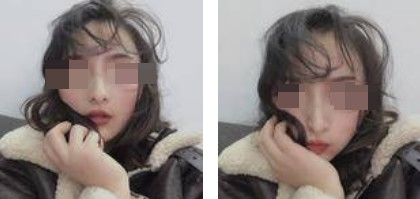 美麗自信的生活從自體軟骨隆鼻開(kāi)始