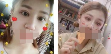 做了全切雙眼皮不僅外表變美了，內(nèi)心也更加自信了