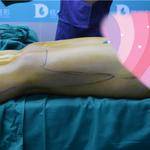 做完雙腿吸脂手術(shù)，穿上我的長(zhǎng)筒靴，盡顯女性魅力！