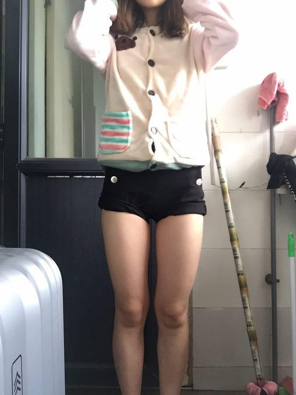 成都美立方整形醫(yī)院黃華醫(yī)生做大腿吸脂怎么樣？附大腿吸脂案例