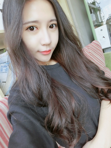  濟(jì)南安美醫(yī)療整形醫(yī)生李思思做下頜角整形怎么樣？李思思下頜角整形案例