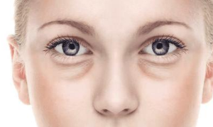 重慶聯(lián)合麗格美容醫(yī)院激光祛眼袋