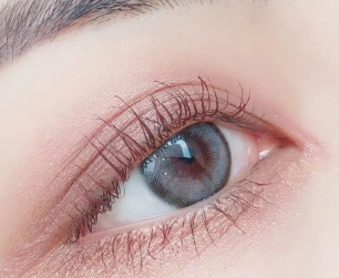 珠海艾瑞整形做雙眼皮修復(fù)