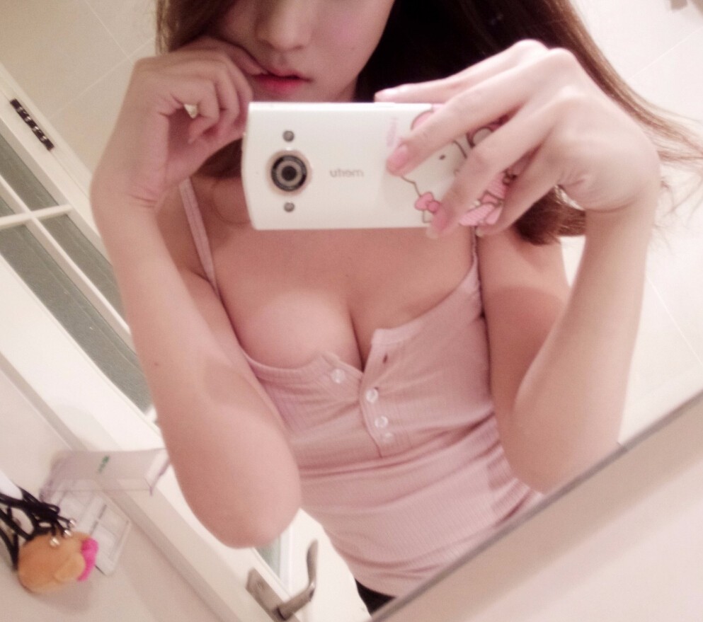 鄭州麗天整形美容醫(yī)院范巨峰醫(yī)生做假體+自體脂肪隆胸效果怎么樣?附真人案例 鄭州麗天整形美容醫(yī)院范巨峰醫(yī)生做假體+自體脂肪隆胸效果怎么樣?附真人案例