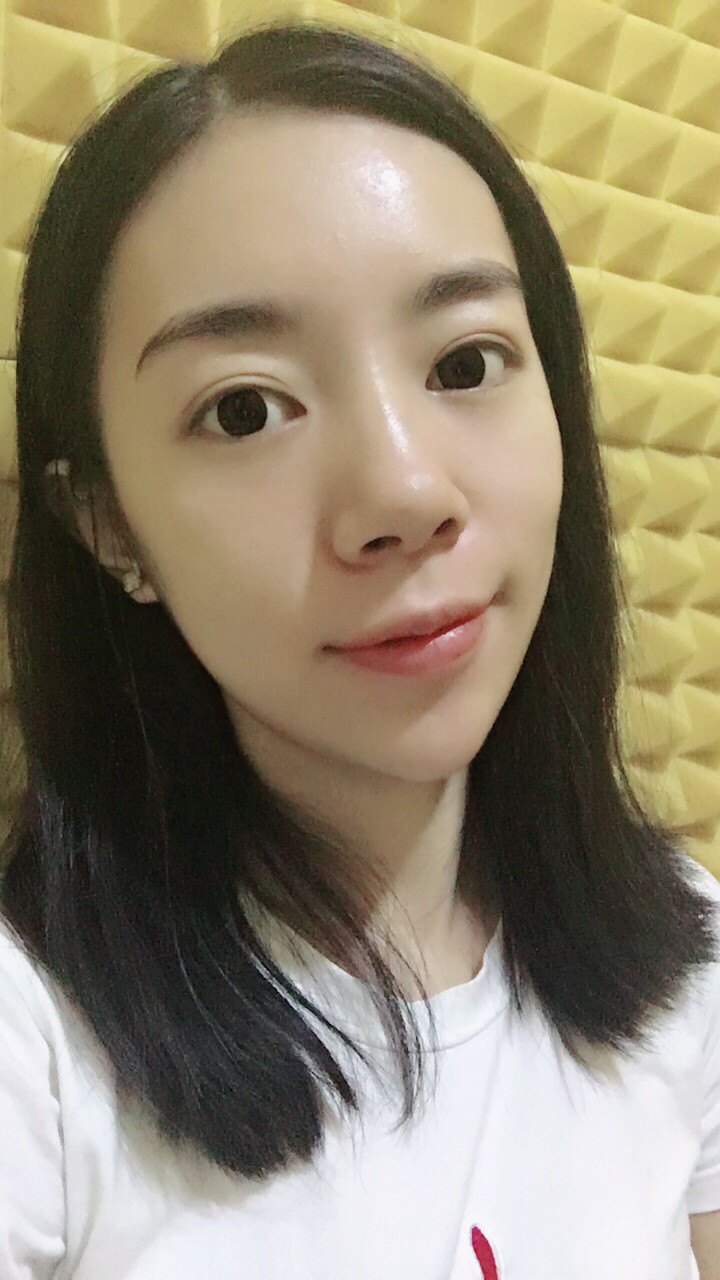 做完祛眼袋手術7天