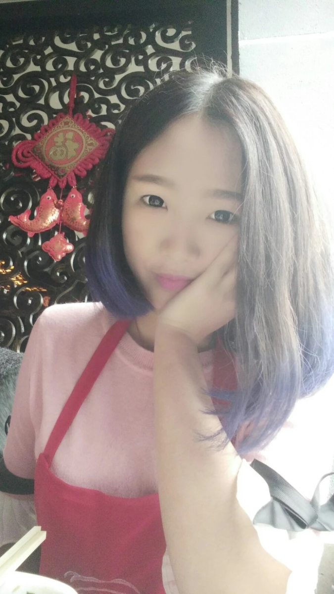 西安米蘭柏羽整形醫(yī)院李旭平做切開雙眼皮效果怎么樣？附案例