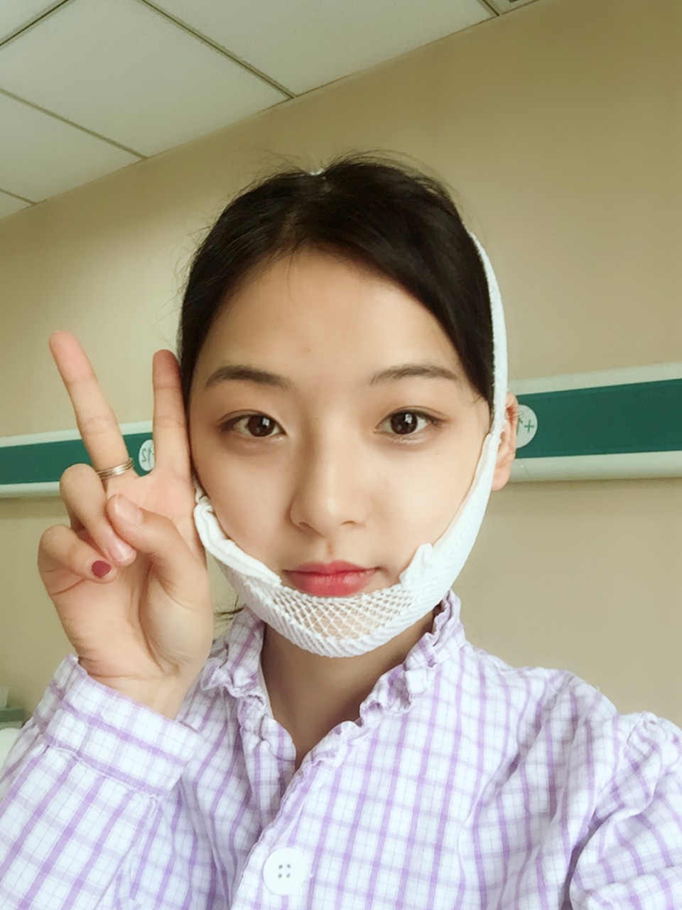 鄭州名門整形醫(yī)院董斌醫(yī)生做下頜角整形怎么樣？附下頜角整形案例