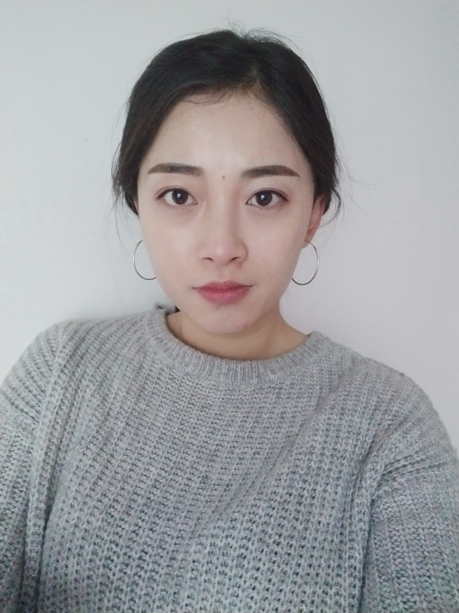 重慶當(dāng)代整形李敏旭醫(yī)生做皮秒激光祛斑效果怎么樣？附皮秒激光祛斑案例