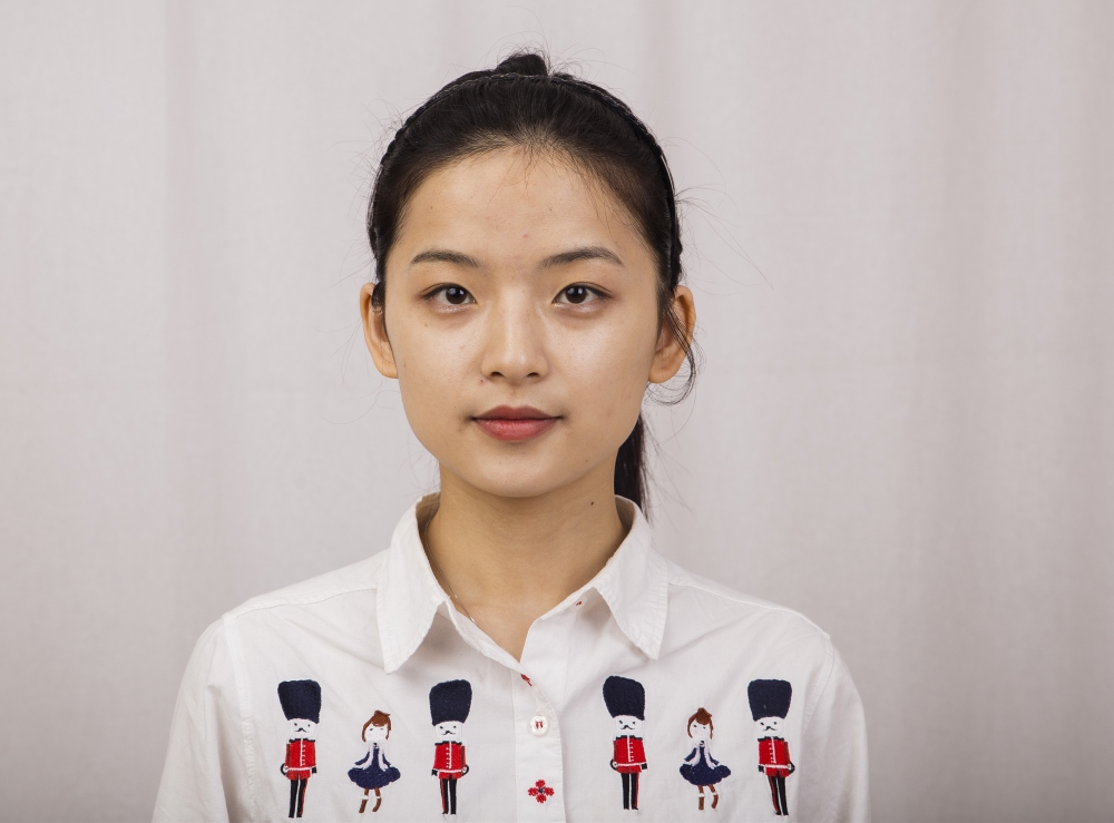 鄭州名門整形醫(yī)院董斌醫(yī)生做下頜角整形怎么樣？附下頜角整形案例
