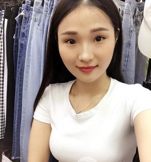珠海萊茵醫(yī)療美容醫(yī)院崔俊溶醫(yī)生做自體脂肪隆胸效果怎么樣？附自體脂肪隆胸案例