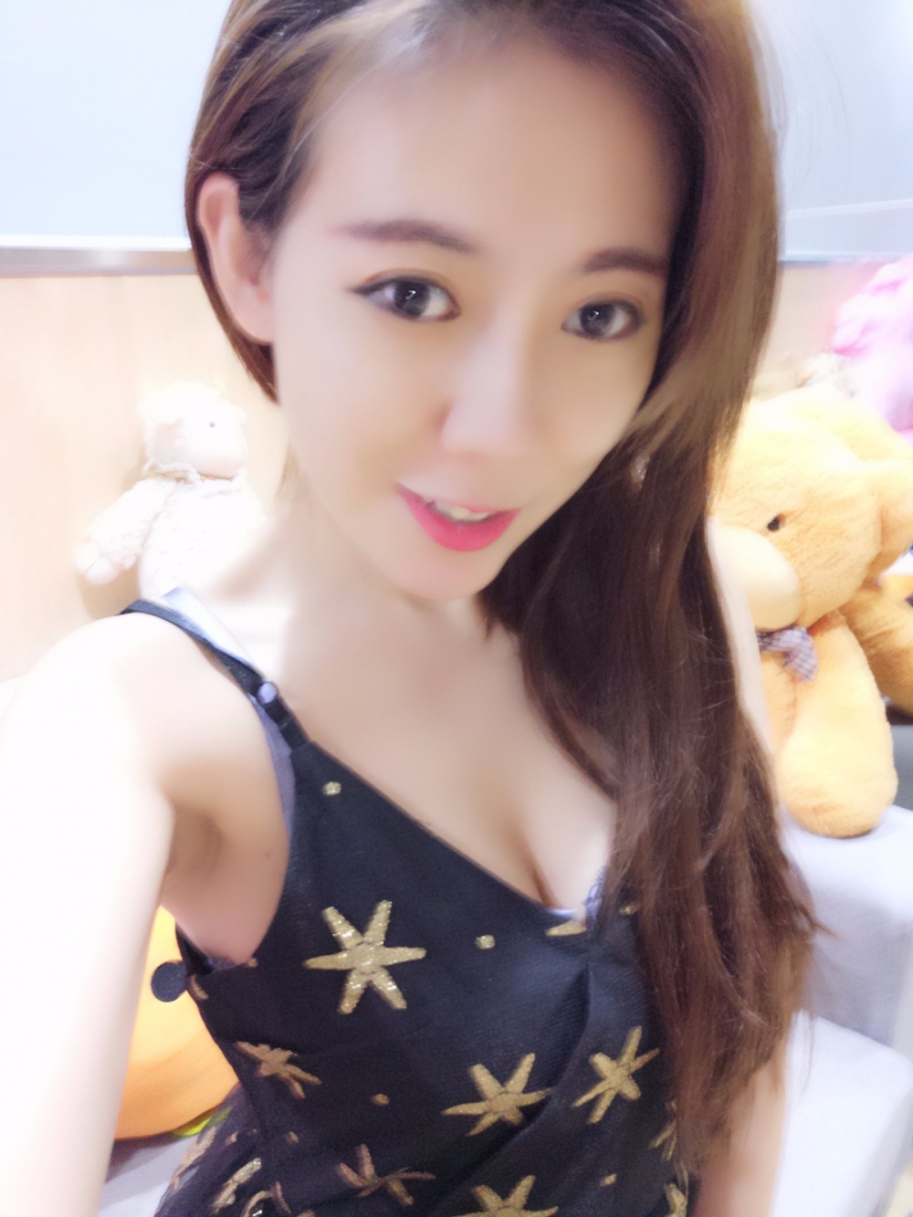 煙臺(tái)壹美整形醫(yī)院朱建瑩醫(yī)生做自體脂肪隆胸怎么樣？附自體脂肪隆胸案例