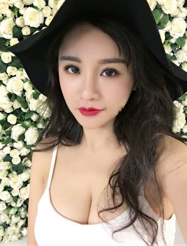 海南韓美醫(yī)學(xué)美容醫(yī)院李強(qiáng)醫(yī)生做自體脂肪隆胸效果怎么樣？附案例