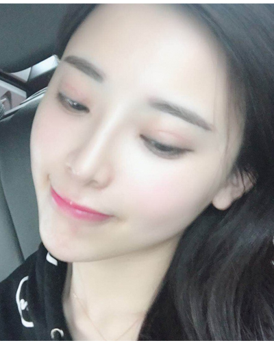 襄陽(yáng)維多利亞整形醫(yī)院安邰晥醫(yī)生做鼻綜合整形怎么樣？附鼻綜合整形案例