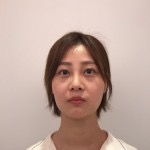 天津歐華威莎整形醫(yī)生姚玲做面部埋線提升效果怎么樣？附埋線提升案例