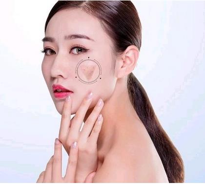 ?？诩t妝尚整形光子嫩膚