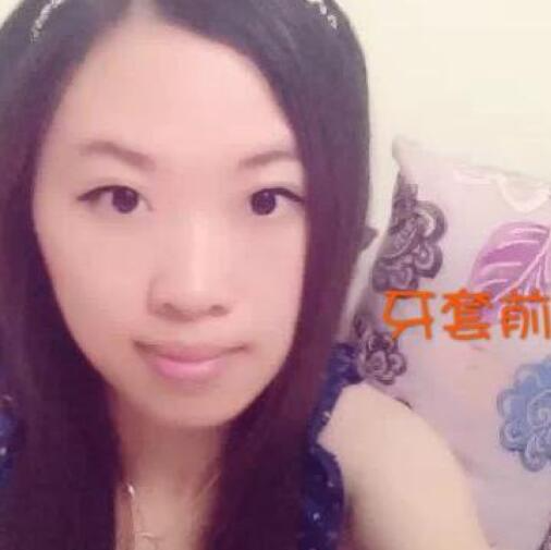 重慶嘉悅口腔醫(yī)院周繼祥醫(yī)生做金屬托槽矯正效果怎么樣？附案例效果對比圖