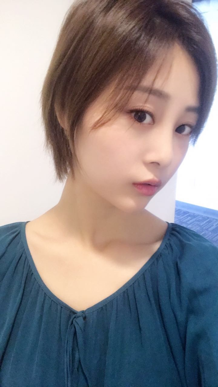 天津歐華威莎整形醫(yī)生姚玲做面部埋線提升效果怎么樣？附埋線提升案例