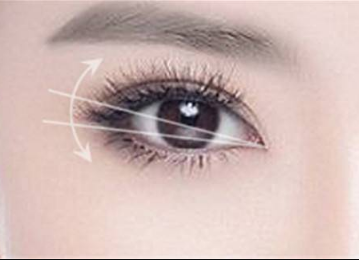 懷化致臻美悅時尚整形埋線雙眼皮