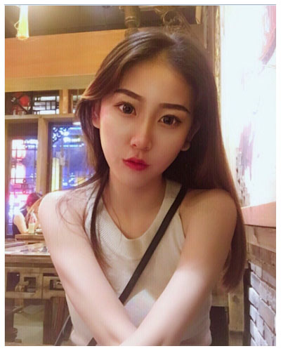 珠海海大整形美容外科黃發(fā)醫(yī)生做面部吸脂怎么樣？附面部吸脂案例