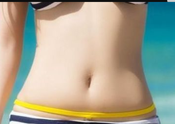 濟(jì)南海峽美容整形醫(yī)院腰腹吸脂
