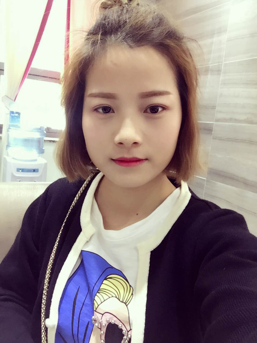 西安藝星醫(yī)療整形醫(yī)院李國玲做鼻綜合整形怎么樣？附李國玲鼻綜合整形案例