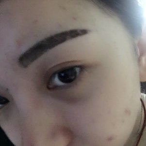 大同清木整形醫(yī)院張樹(shù)霞醫(yī)生做半永久紋眉效果如何？附半永久紋眉效果圖