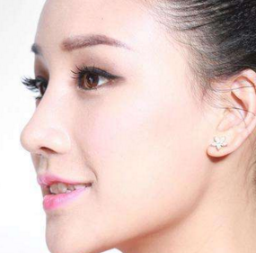 唐山京順整形醫(yī)院歪鼻矯正