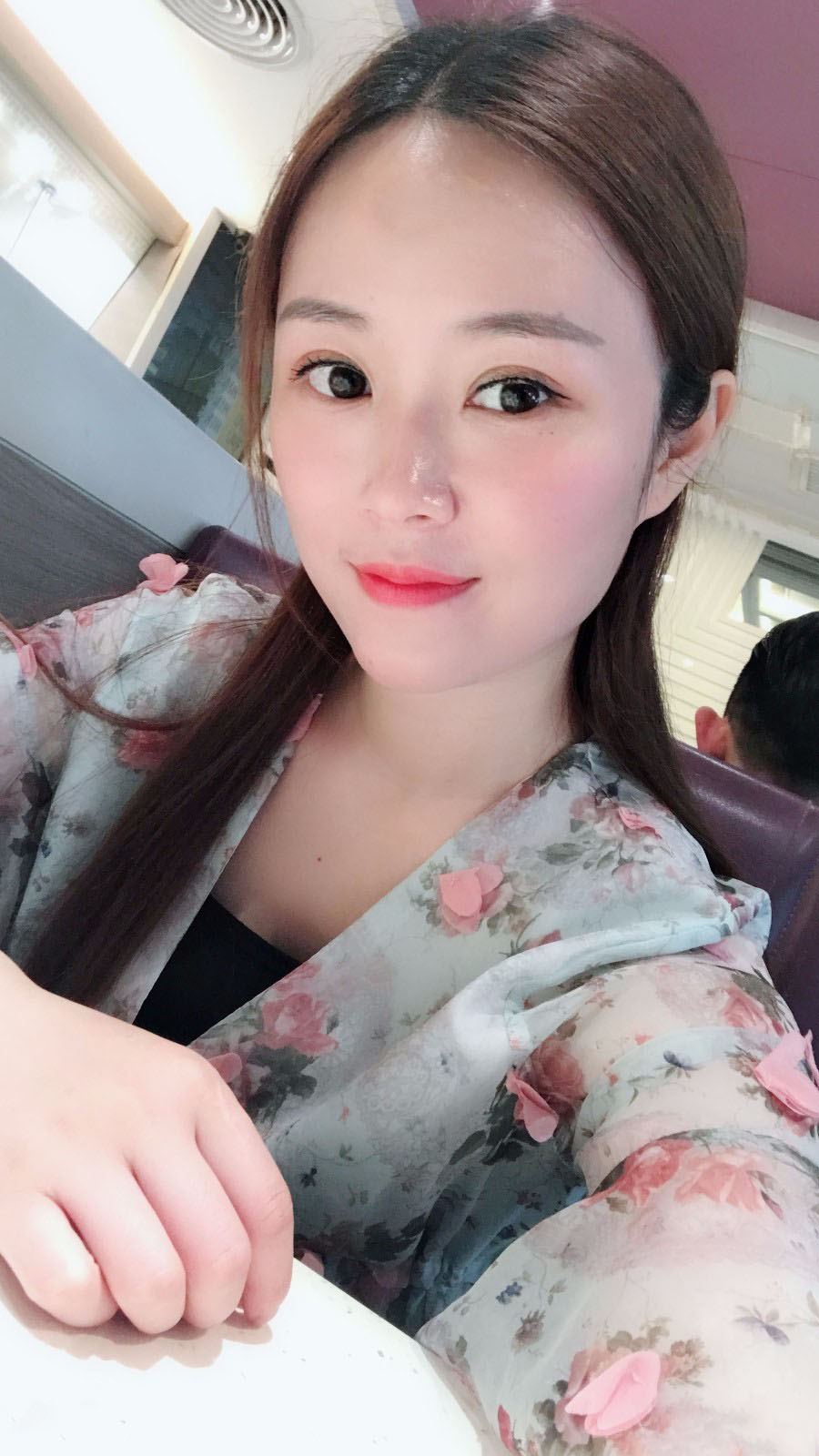 廣東韓妃醫(yī)療美容醫(yī)院做切開雙眼怎么樣？附案例效果圖