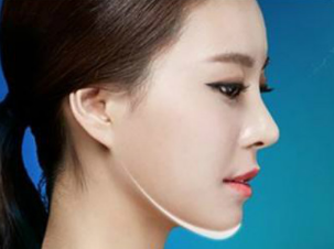 鄭州第一人民醫(yī)院假體隆下巴