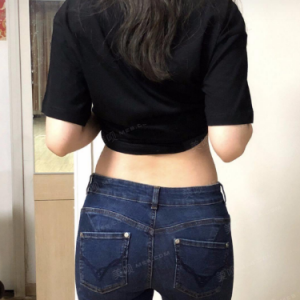 北京可思美整形醫(yī)院醫(yī)生斯勤做腰腹吸脂怎么樣？附案例效果對(duì)比圖