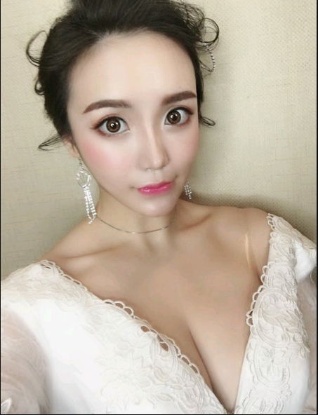 重慶當(dāng)代整形美容醫(yī)院醫(yī)生楊健做假體隆胸怎么樣？附案例