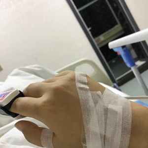 河南協(xié)和醫(yī)院整形外科醫(yī)生騰利做自體脂肪隆胸怎么樣？附案例效果對比圖