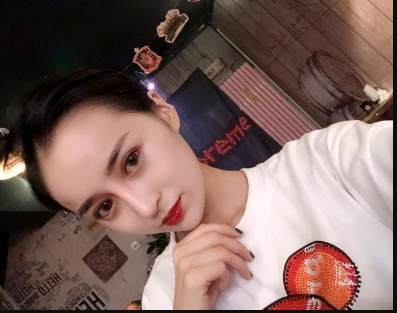 武漢米蘭醫(yī)療美容醫(yī)生柳再億做眼綜合+鼻綜合整形怎么樣？附真實案例對比圖