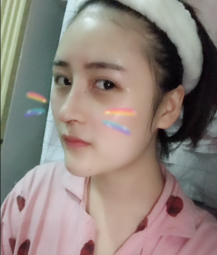 北京伊美爾美容愛康醫(yī)院醫(yī)生柳成做鼻綜合整形怎么樣？附案例效果圖