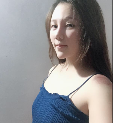 北京東方和諧醫(yī)療整形診所馮斌醫(yī)生做假體隆胸怎么樣？附案例效果對比圖