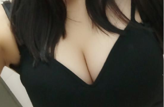 武漢伽美醫(yī)療美容醫(yī)院醫(yī)生朱富初做自體脂肪隆胸怎么樣？看案例