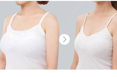 成都濟(jì)慈德美醫(yī)療美容門診部巨乳縮小