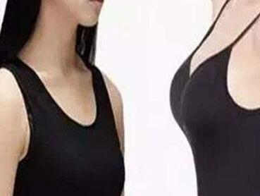 大連沙醫(yī)生整形美容口腔?？漆t(yī)院自體脂肪豐胸