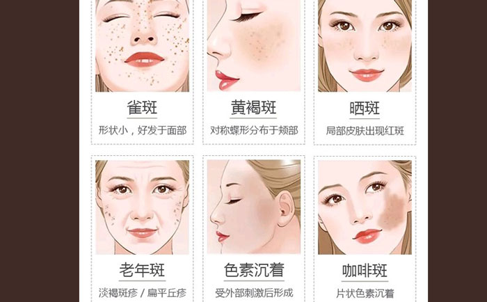 醫(yī)院激光祛斑貴不貴？正規(guī)醫(yī)院激光祛斑多少錢？
