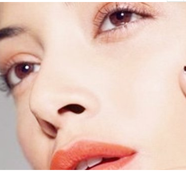 安徽韓美整形美容醫(yī)院假體隆鼻