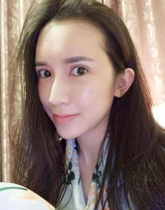 上海時光整形醫(yī)院張晶醫(yī)生做開眼角怎么樣？附真實效果圖