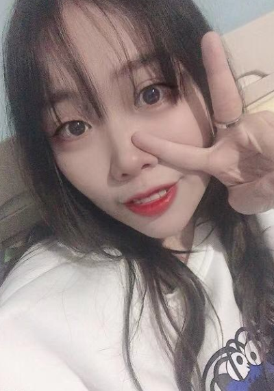 合肥韓美整形美容醫(yī)院做去眼袋效果怎么樣?附金壽信醫(yī)生去眼袋案例效果圖