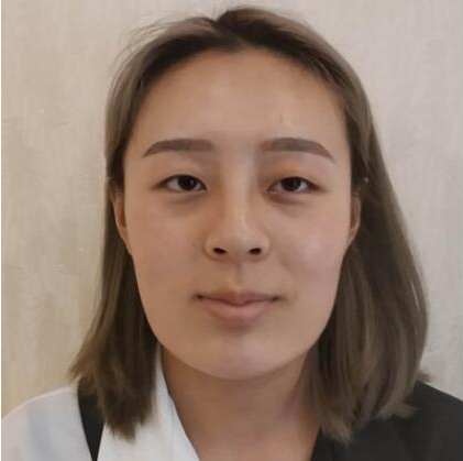 上海時光整形外科醫(yī)院雙眼皮+隆鼻+下頜角案例
